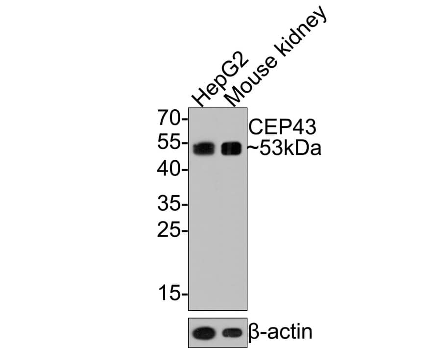 FGFR1OP Antibody (JE64-24)