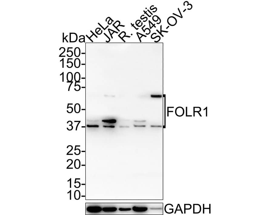 FOLR1 Antibody (JE31-40)