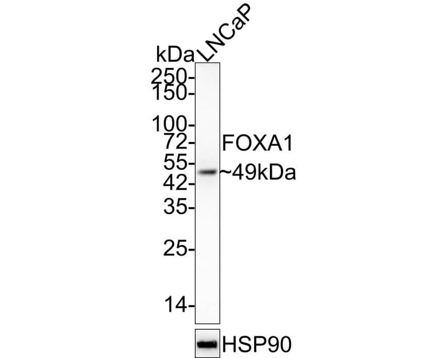 HNF-3 alpha/FoxA1 Antibody (A2E8-R)