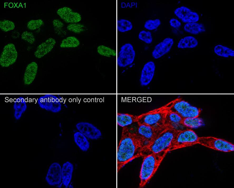HNF-3 alpha/FoxA1 Antibody (A2E8-R)