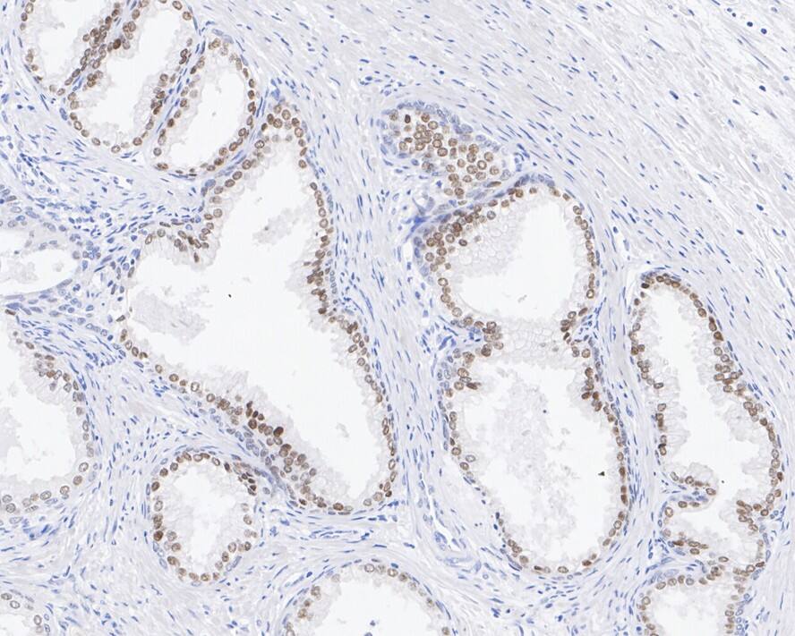 HNF-3 alpha/FoxA1 Antibody (A2E8-R)