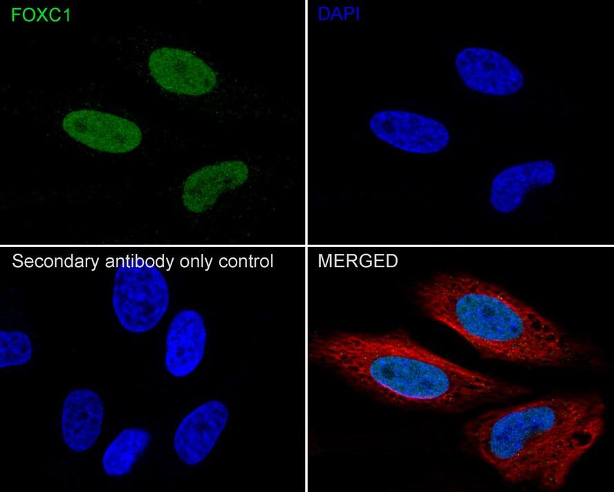 FoxC1 Antibody (PSH03-89)