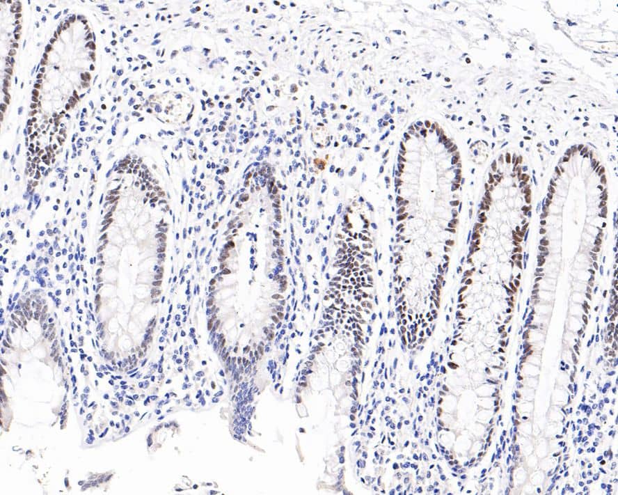 FoxP1 Antibody (PD00-47)