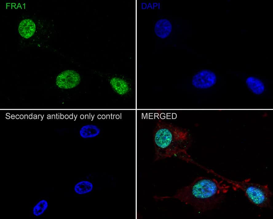 FRA-1/FOSL1 Antibody (JE33-20)