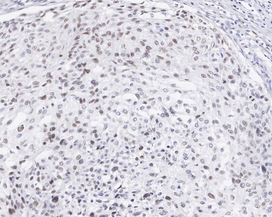FRA-1/FOSL1 Antibody (JE33-20)