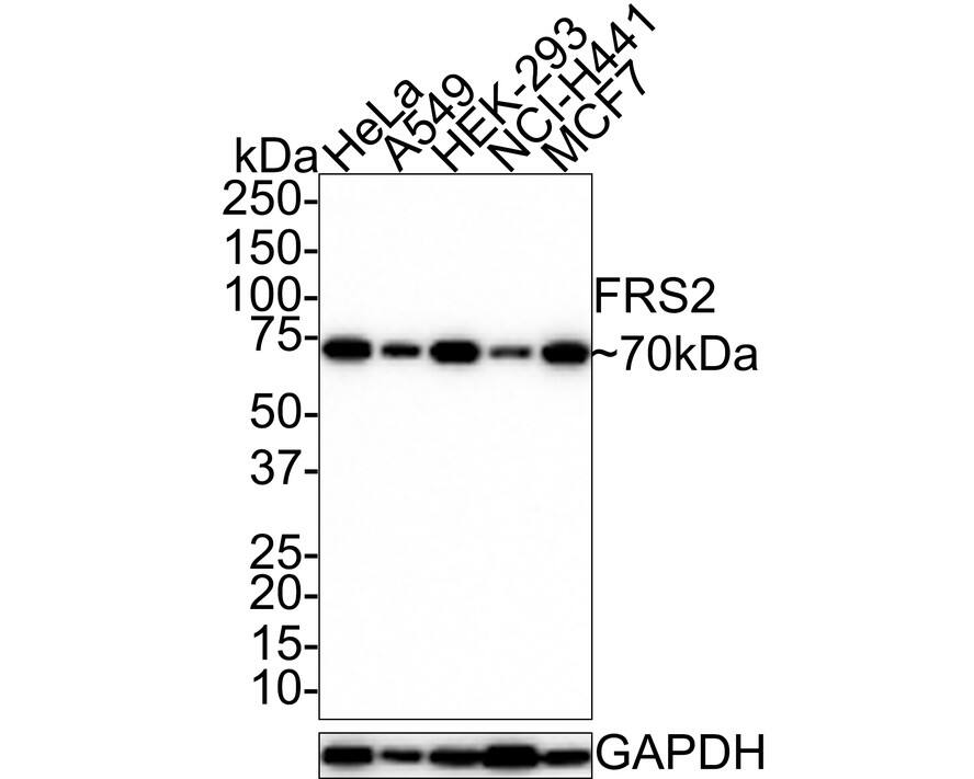 FRS2 Antibody (JE30-77)