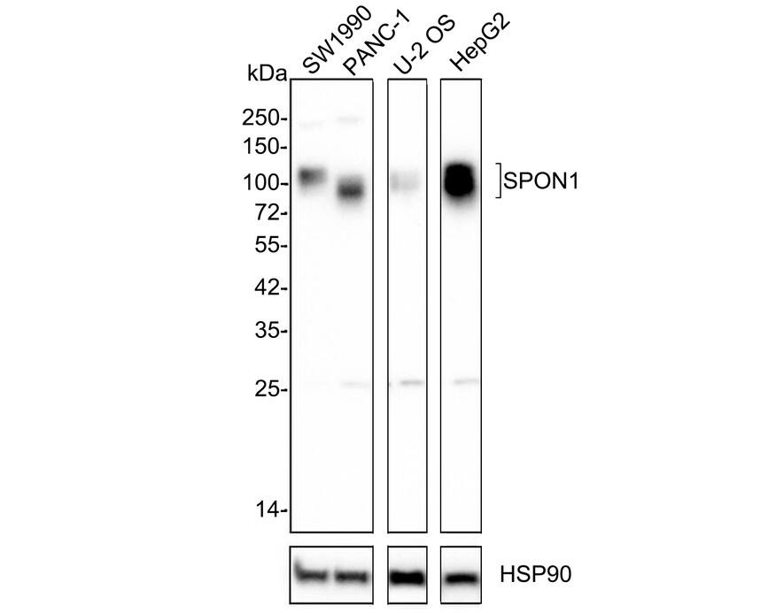 F-Spondin/SPON1 Antibody (PSH02-84)