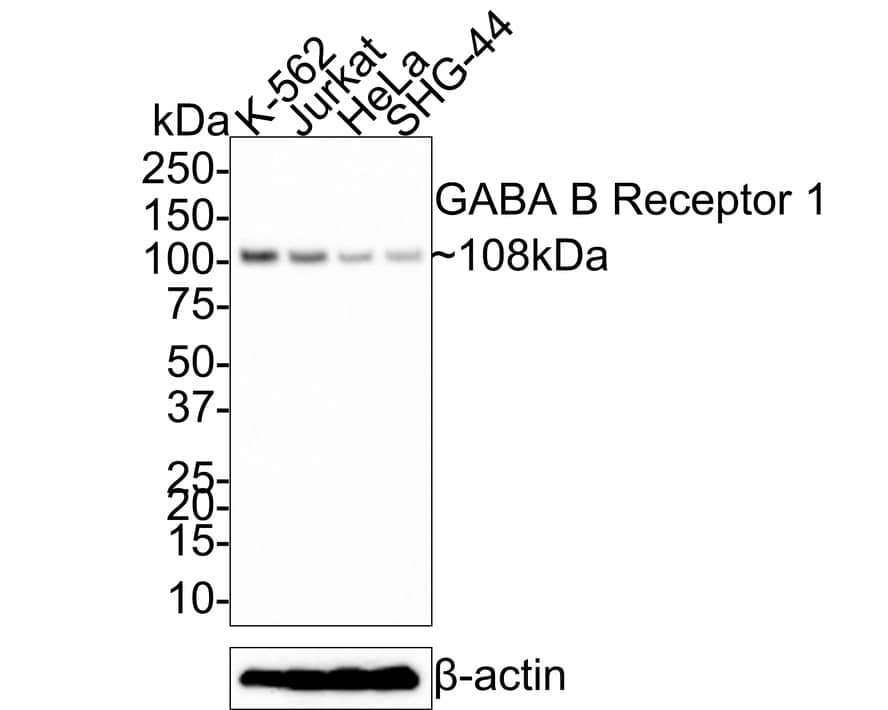 GABA-B R1 Antibody (JE60-09)