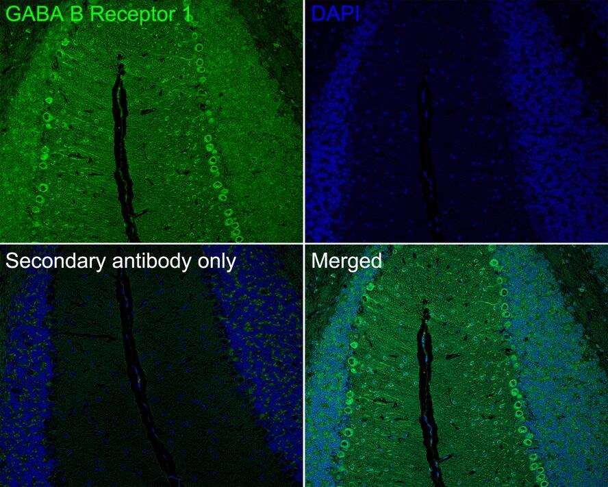 GABA-B R1 Antibody (PSH03-87)