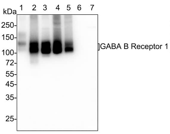 GABA-B R1 Antibody (PSH03-87)