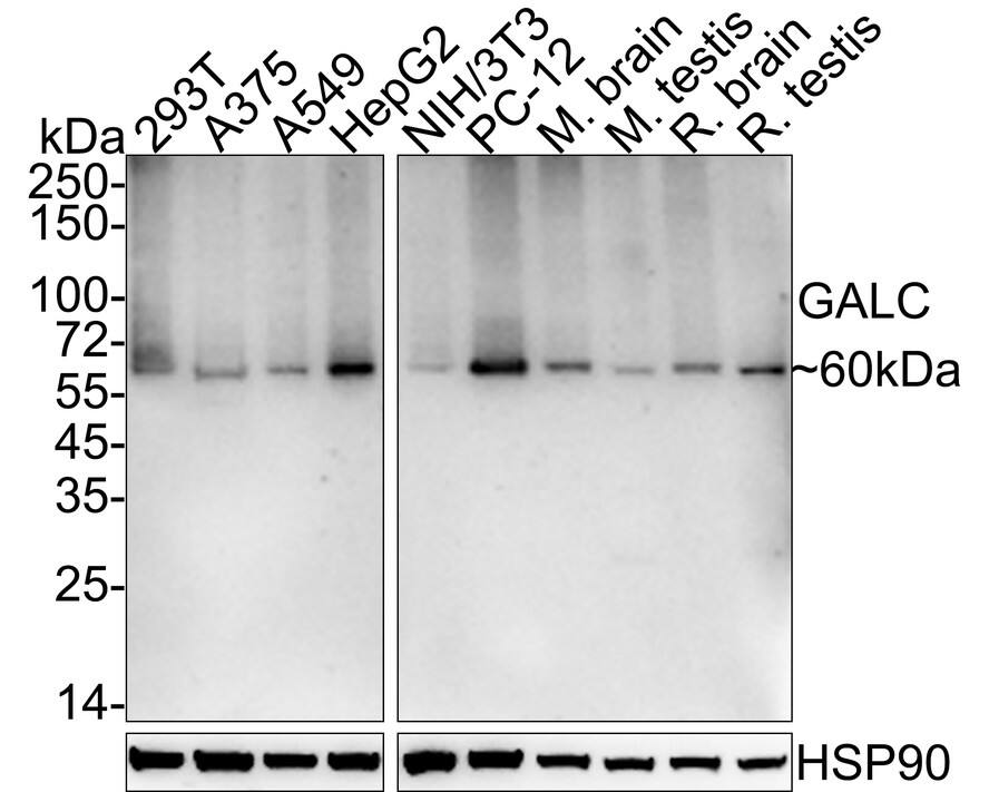 Galactosylceramidase/GALC Antibody (PSH03-45)