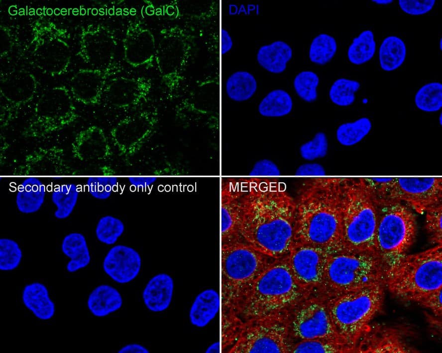 Galactosylceramidase/GALC Antibody (PSH03-45)