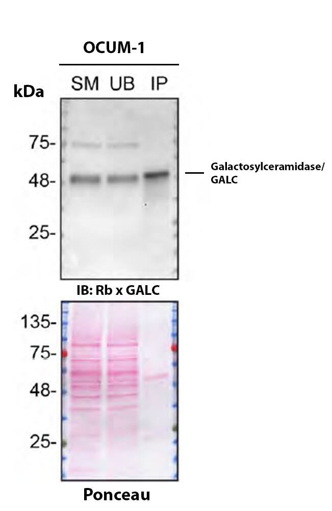 Galactosylceramidase/GALC Antibody (PSH03-45) Detection of Galactosylceramidase/GALC by Immunoprecipitation.