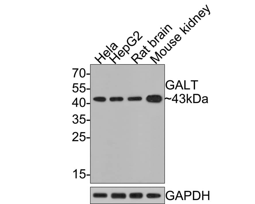 GALT Antibody (JE64-66)