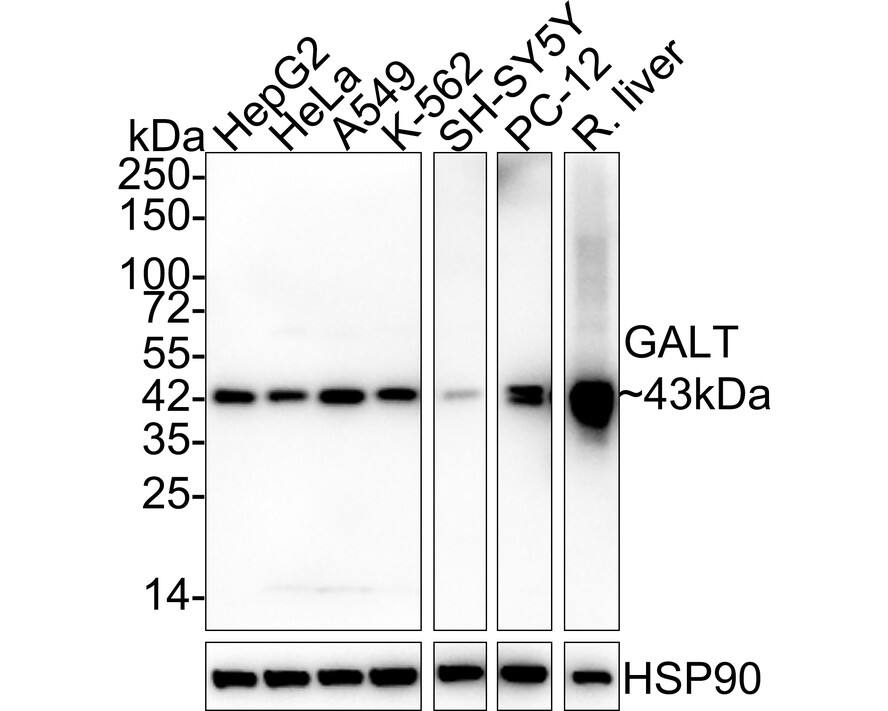 GALT Antibody (PSH02-87)