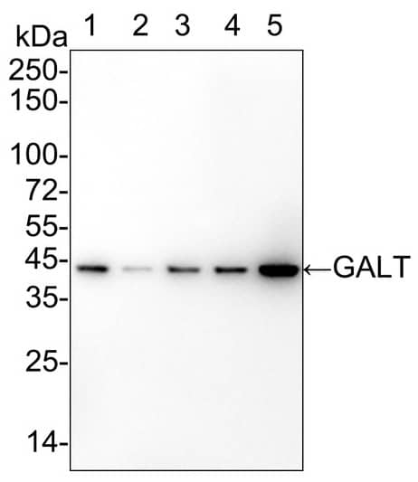 GALT Antibody (PSH02-88)