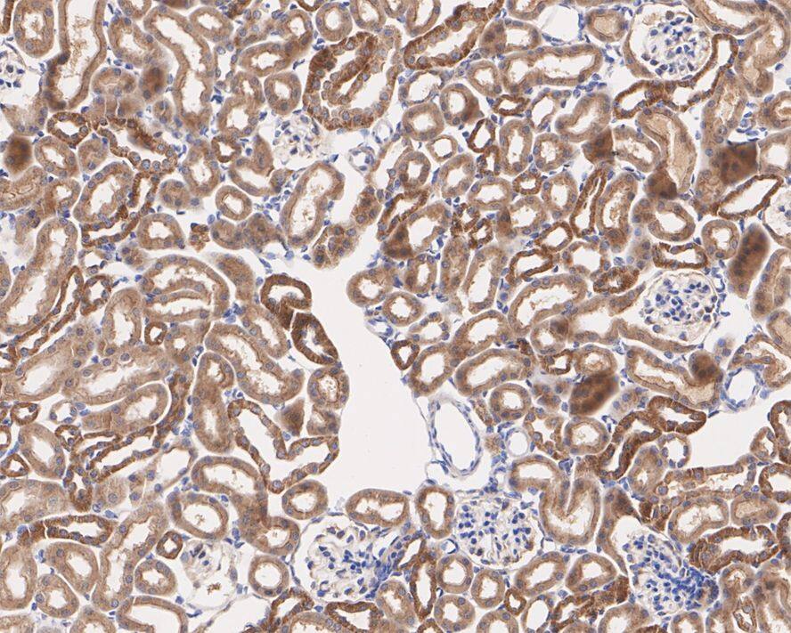 Gamma Adaptin Antibody (PSH02-65)