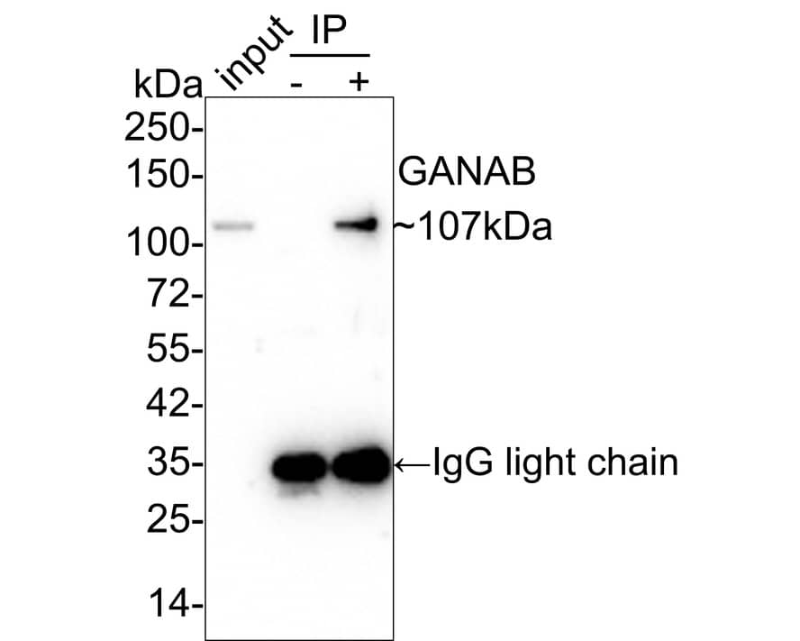 alpha Glucosidase 2 Antibody (PSH01-52)