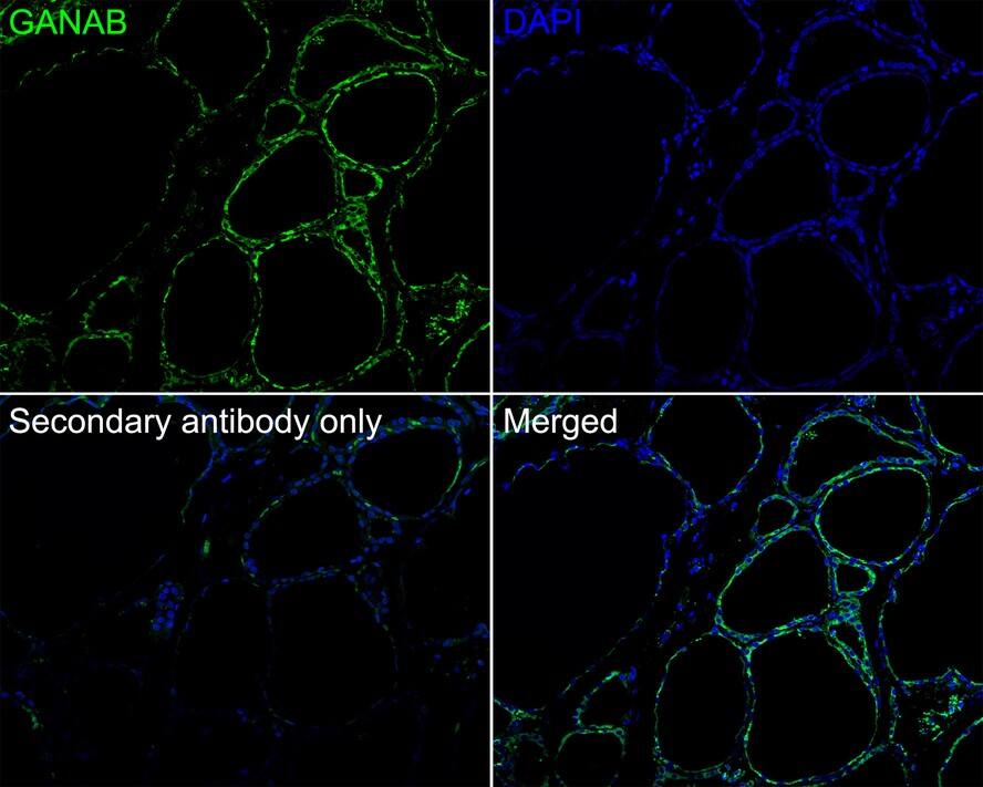 alpha Glucosidase 2 Antibody (PSH01-52)