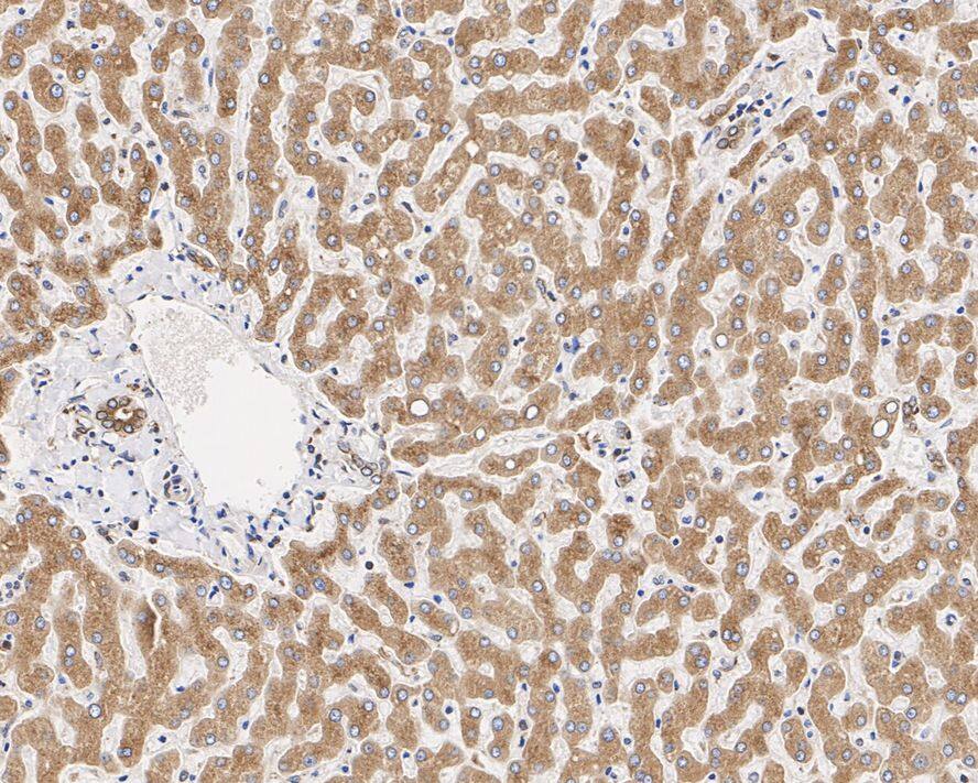 alpha Glucosidase 2 Antibody (PSH01-52)