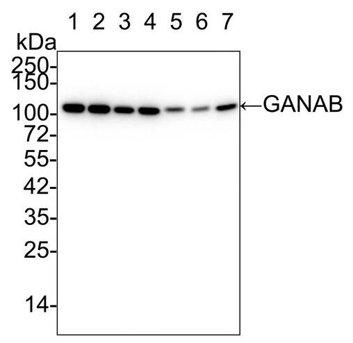 alpha Glucosidase 2 Antibody (PSH01-52)