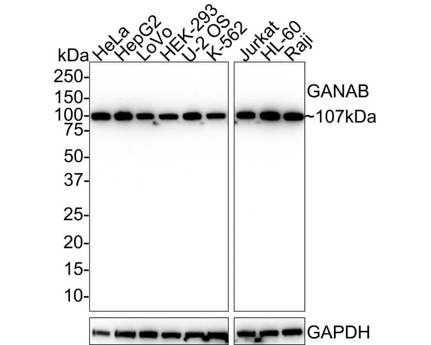 alpha Glucosidase 2 Antibody (PSH01-53)