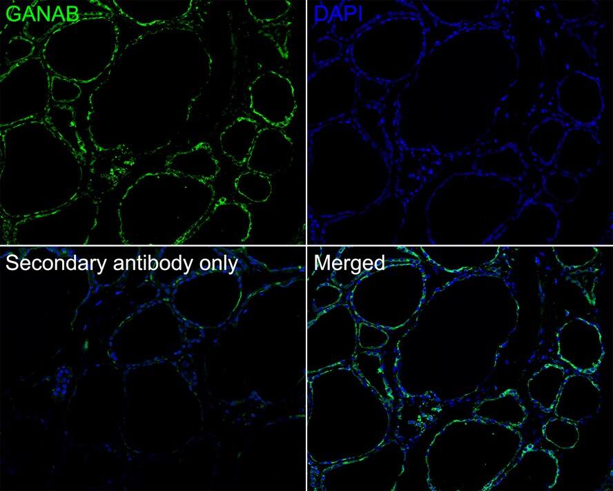alpha Glucosidase 2 Antibody (PSH01-53)