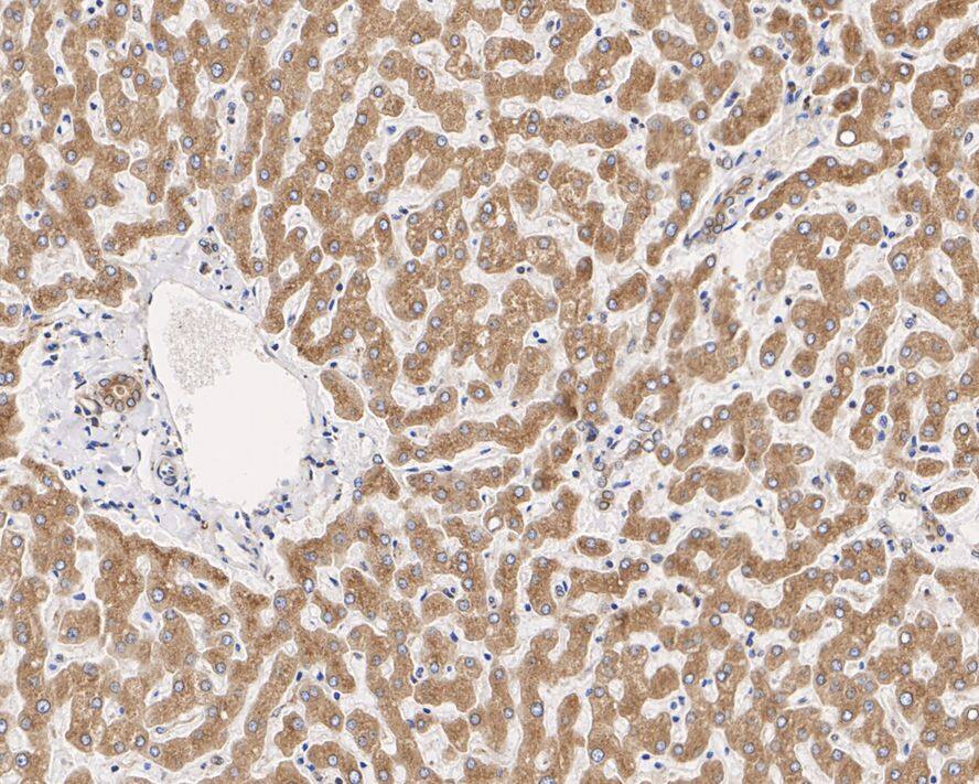 alpha Glucosidase 2 Antibody (PSH01-53)