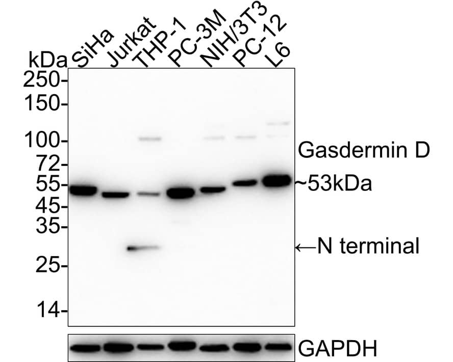 GSDMDC1 Antibody (PD00-18) - N-terminal