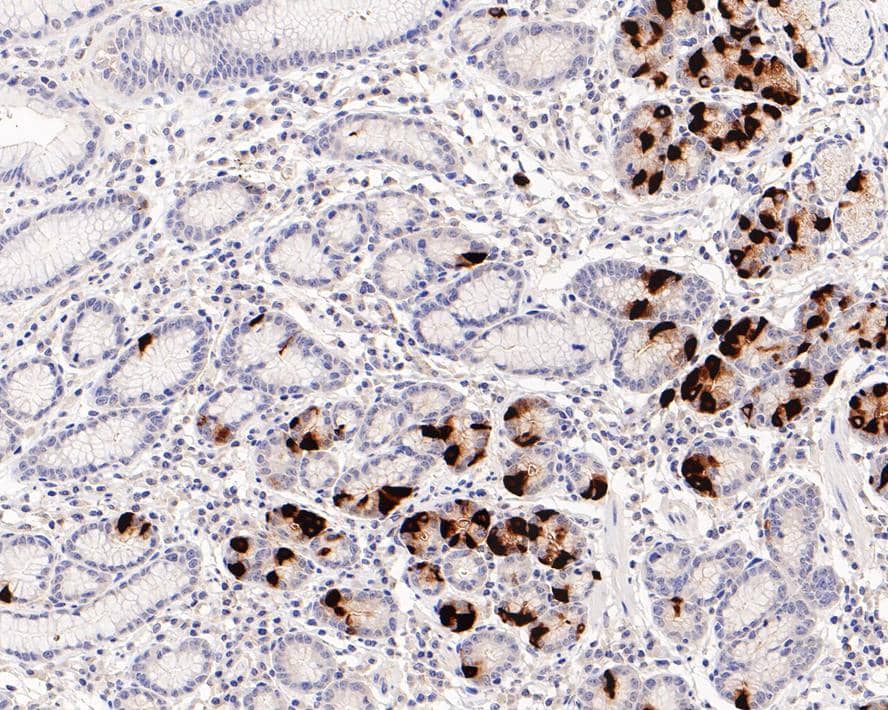 Gastrin Antibody (PD00-37)