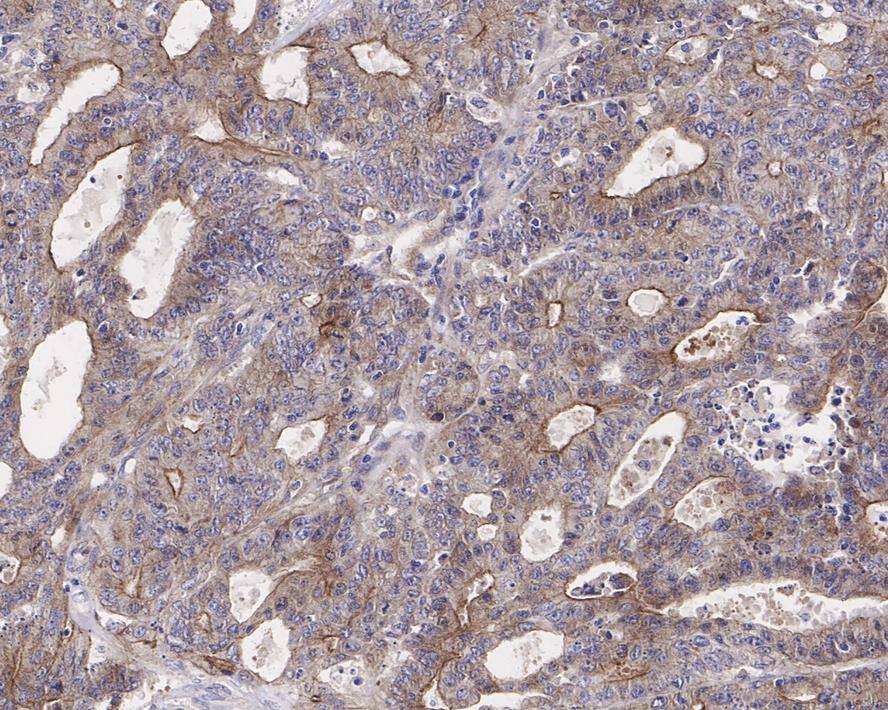 Granulin Antibody (JE37-73)