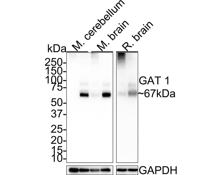 GAT-1/SLC6A1 Antibody (JE34-61)