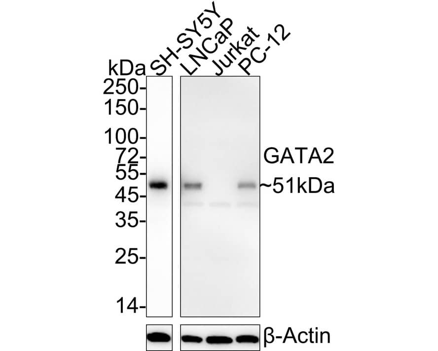 GATA-2 Antibody (PSH04-53)