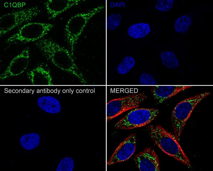 HABP1/C1QBP/GC1q R Antibody (A8F4-R)