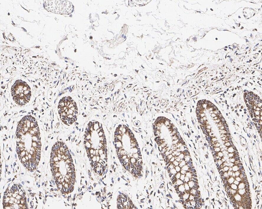 HABP1/C1QBP/GC1q R Antibody (A8F4-R)