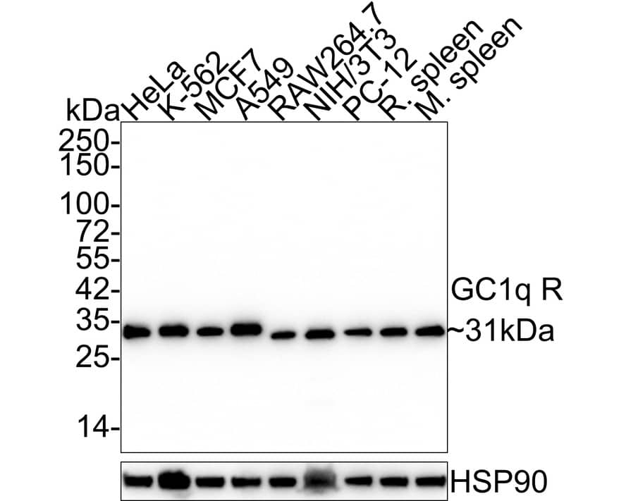 HABP1/C1QBP/GC1q R Antibody (A8F5-R)