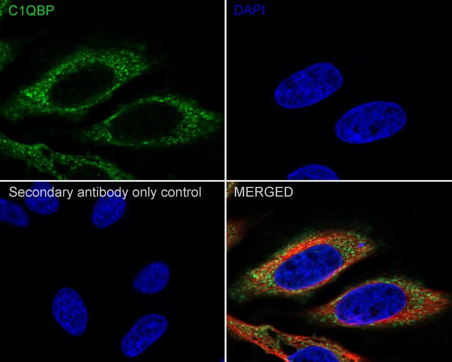 HABP1/C1QBP/GC1q R Antibody (A8F5-R)