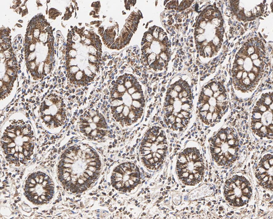 HABP1/C1QBP/GC1q R Antibody (A8F5-R)