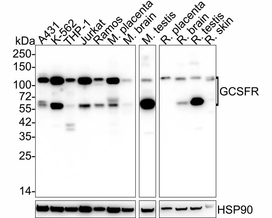 G-CSFR/CD114 Antibody (PSH03-44)