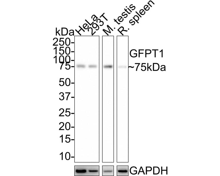 GFPT1 Antibody (JE43-68)