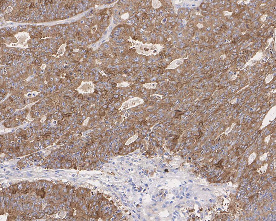 GFPT1 Antibody (JE43-68)