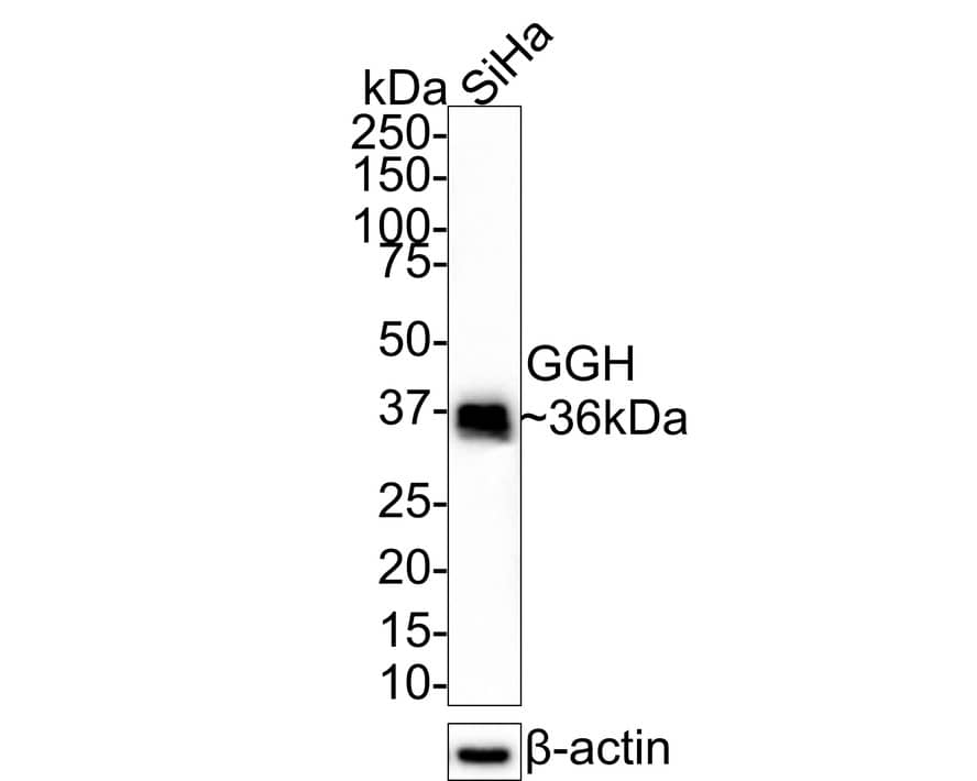 gamma-glutamyl hydrolase Antibody (JE61-78)