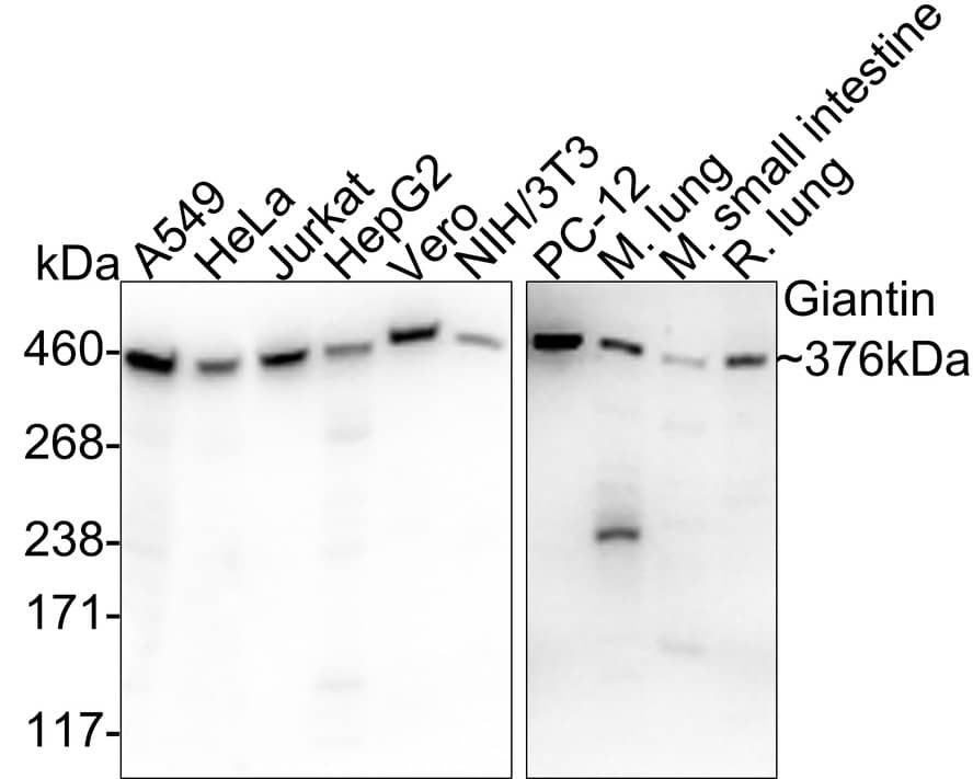 GOLGB1/Giantin Antibody (PSH03-86)