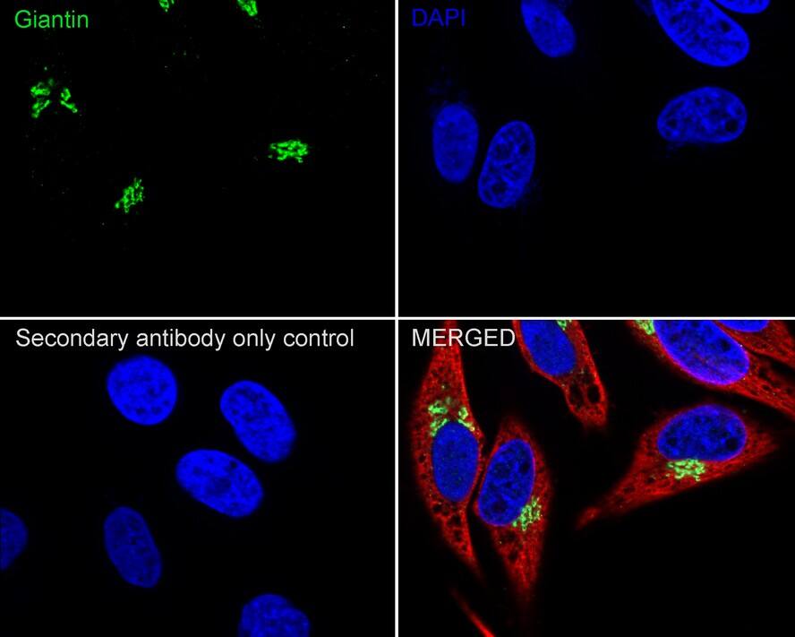 GOLGB1/Giantin Antibody (PSH03-86)