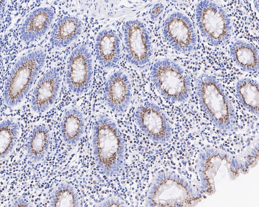 GOLGB1/Giantin Antibody (PSH03-86)