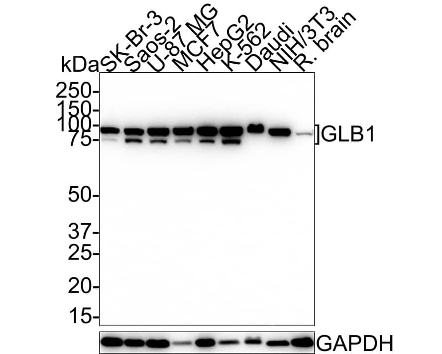 beta-Galactosidase-1/GLB1 Antibody (JE40-77)