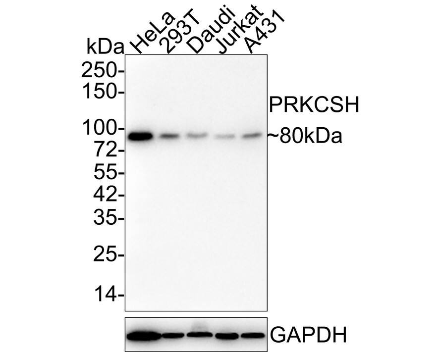 PRKCSH Antibody (A6H9-R)