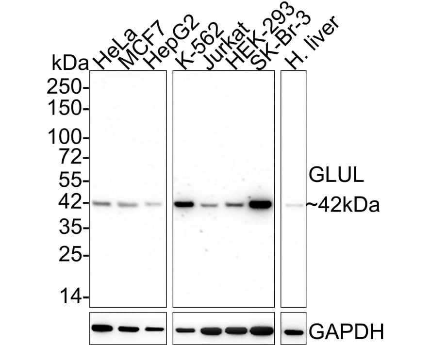 Glutamine Synthetase Antibody (A3G2-R)