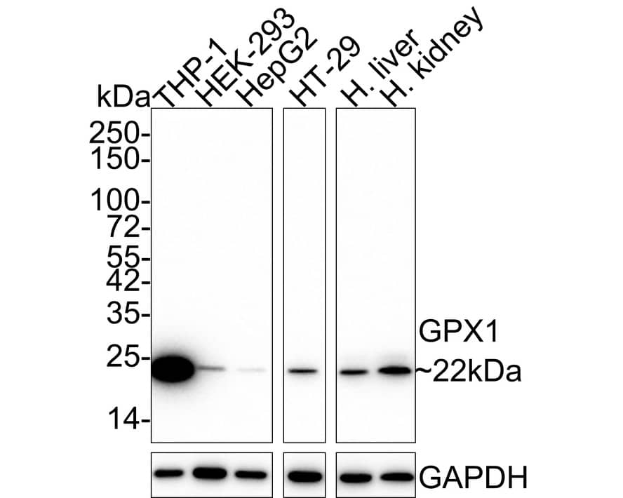 Glutathione Peroxidase 1/GPX1 Antibody (A6-C0-B9-R)