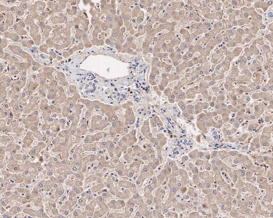 Glutathione Peroxidase 1/GPX1 Antibody (A6-C0-B9-R)